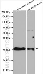 TIGAR Antibody in Western Blot (WB)