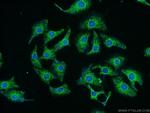 RYK Antibody in Immunocytochemistry (ICC/IF)