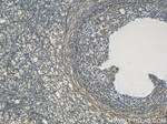 RYK Antibody in Immunohistochemistry (Paraffin) (IHC (P))