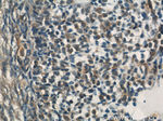 RYK Antibody in Immunohistochemistry (Paraffin) (IHC (P))
