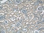 RYK Antibody in Immunohistochemistry (Paraffin) (IHC (P))