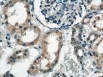 RYK Antibody in Immunohistochemistry (Paraffin) (IHC (P))