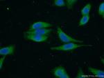 RASAL2 Antibody in Immunocytochemistry (ICC/IF)