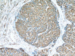 LY6E Antibody in Immunohistochemistry (Paraffin) (IHC (P))