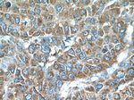LY6E Antibody in Immunohistochemistry (Paraffin) (IHC (P))