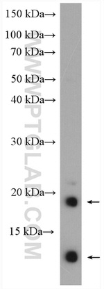 LY6E Antibody in Western Blot (WB)