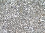 LY6E Antibody in Immunohistochemistry (Paraffin) (IHC (P))