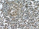LY6E Antibody in Immunohistochemistry (Paraffin) (IHC (P))