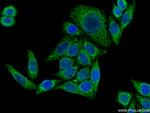 PYCR1 Antibody in Immunocytochemistry (ICC/IF)