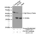 PYCR1 Antibody in Immunoprecipitation (IP)