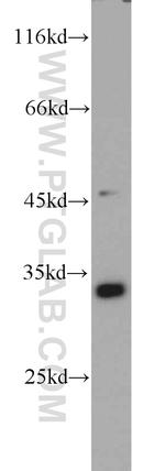 PYCR1 Antibody in Western Blot (WB)