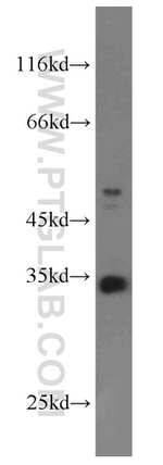PYCR1 Antibody in Western Blot (WB)
