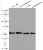 TRIM72 Antibody in Western Blot (WB)