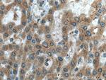 C3orf10 Antibody in Immunohistochemistry (Paraffin) (IHC (P))