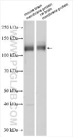 KCNMA1 Antibody in Western Blot (WB)