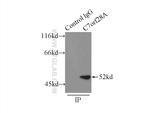 CCZ1 Antibody in Immunoprecipitation (IP)