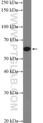 ZNF154 Antibody in Western Blot (WB)