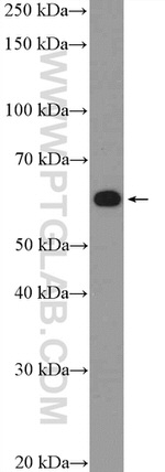 ZNF154 Antibody in Western Blot (WB)