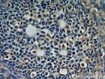LPAR4 Antibody in Immunohistochemistry (Paraffin) (IHC (P))