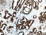 IQGAP1 Antibody in Immunohistochemistry (Paraffin) (IHC (P))