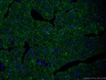 CPT1B Antibody in Immunohistochemistry (PFA fixed) (IHC (PFA))