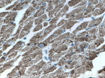 CPT1B Antibody in Immunohistochemistry (Paraffin) (IHC (P))