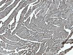 CPT1B Antibody in Immunohistochemistry (Paraffin) (IHC (P))