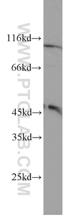 FOXP3 Antibody in Western Blot (WB)