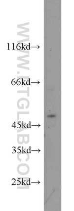 FOXP3 Antibody in Western Blot (WB)