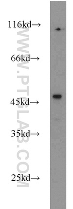 FOXP3 Antibody in Western Blot (WB)