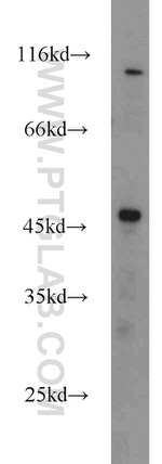 FOXP3 Antibody in Western Blot (WB)