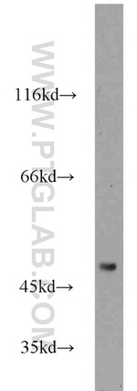 FOXP3 Antibody in Western Blot (WB)