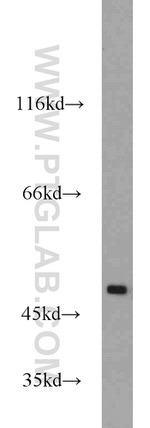 FOXP3 Antibody in Western Blot (WB)