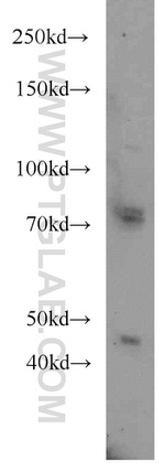 FOXP3 Antibody in Western Blot (WB)