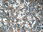 ARHGAP21 Antibody in Immunohistochemistry (Paraffin) (IHC (P))