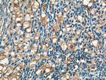 ARHGAP21 Antibody in Immunohistochemistry (Paraffin) (IHC (P))