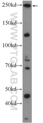ARHGAP21 Antibody in Western Blot (WB)