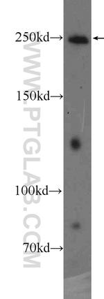 ARHGAP21 Antibody in Western Blot (WB)