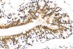 SS18 Antibody in Immunohistochemistry (Paraffin) (IHC (P))