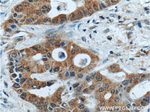 BMP3 Antibody in Immunohistochemistry (Paraffin) (IHC (P))