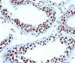 JAZF1 (Transcription Corepressor) Antibody in Immunohistochemistry (Paraffin) (IHC (P))
