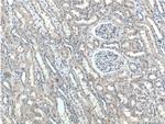 SNX21 Antibody in Immunohistochemistry (Paraffin) (IHC (P))