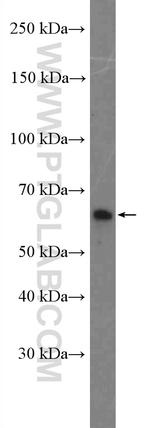 SH2B3 Antibody in Western Blot (WB)