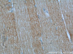Desmin Antibody in Immunohistochemistry (Paraffin) (IHC (P))
