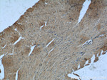 Desmin Antibody in Immunohistochemistry (Paraffin) (IHC (P))