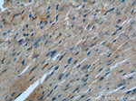 Desmin Antibody in Immunohistochemistry (Paraffin) (IHC (P))