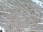 Desmin Antibody in Immunohistochemistry (Paraffin) (IHC (P))