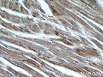 Desmin Antibody in Immunohistochemistry (Paraffin) (IHC (P))
