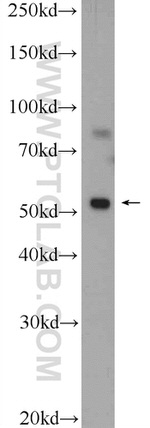 Desmin Antibody in Western Blot (WB)
