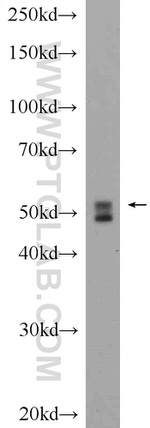 Desmin Antibody in Western Blot (WB)
